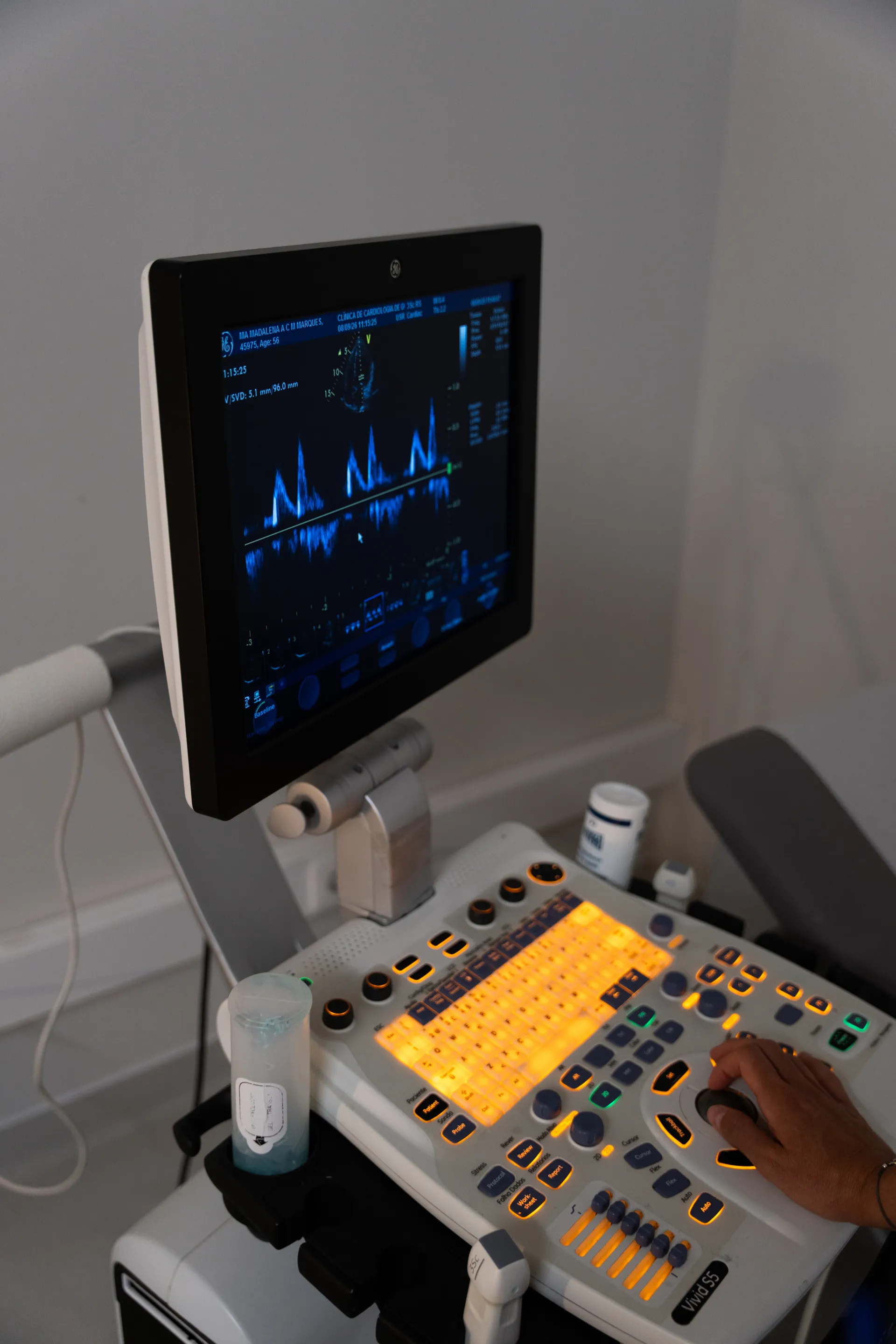 ecocardiograma com Doppler